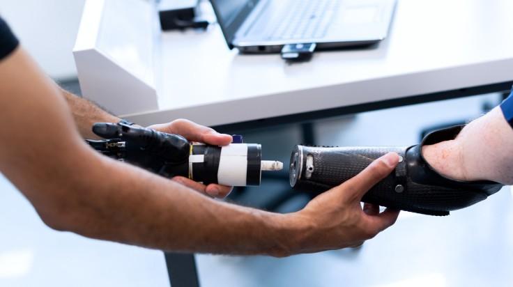 Learn how prosthetics can transform disabilities into opportunities for patients Learn how prosthetics can transform disabilities into opportunities for patients